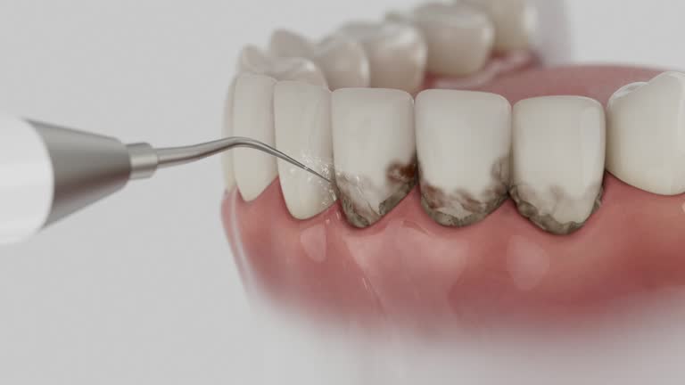 Reliable Dental Implants contractor in Somerville, TN by Smile Center Dentistry